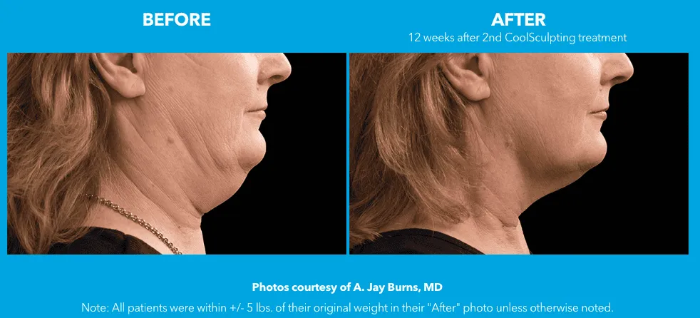 a comparison of a woman's face