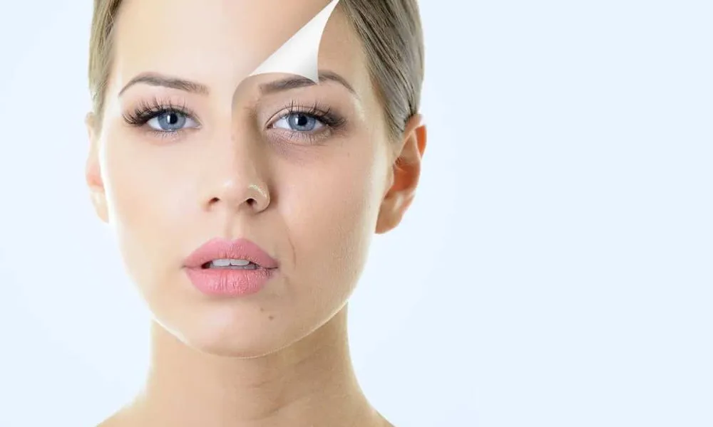 Sculptra by Magnolia Medical Aesthetics in Riverside CA