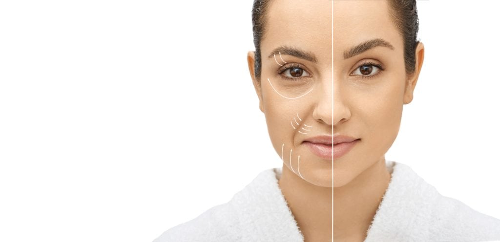 Venus Viva Skin Tightening & Skin Resurfacing Treatments